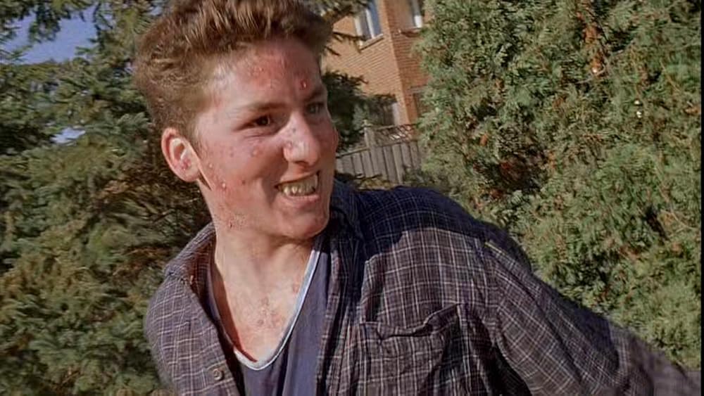 گاز گرفتن جینجر