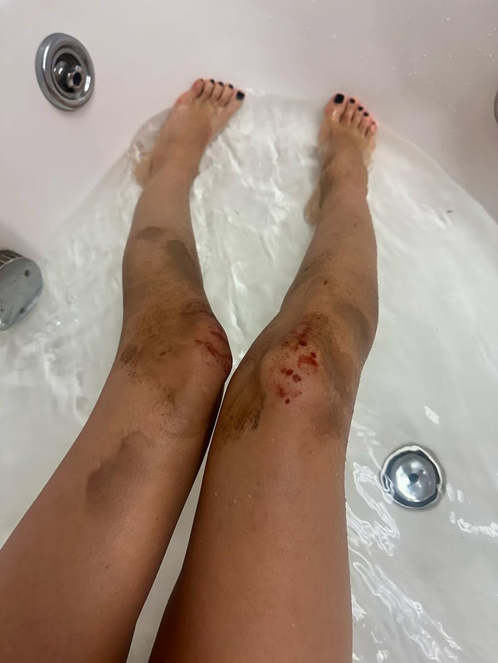 می‌دانم تابستان پیش چه کردی