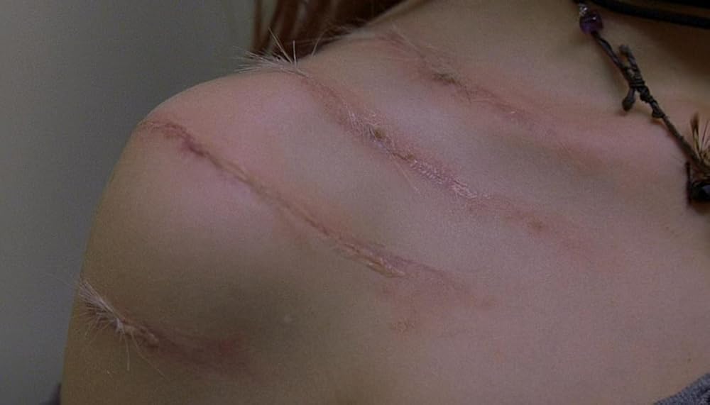 گاز گرفتن جینجر